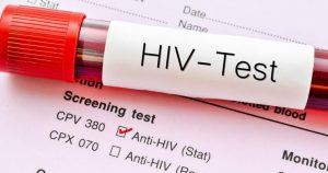 HIV
