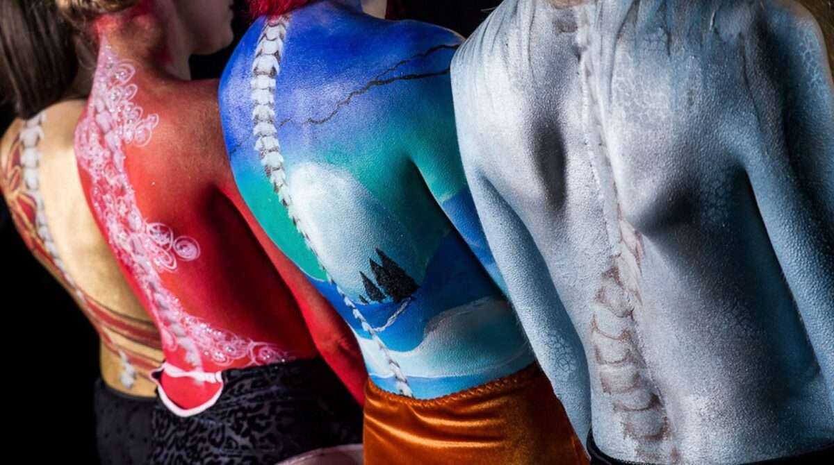 scoliosis