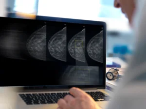 Recent Advancements in Breast Imaging Radiology A Comprehensive Review