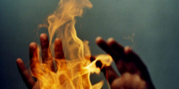 Young man set ablaze by in-laws in Sindh’s Thul dies