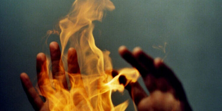 Young man set ablaze by in-laws in Sindh’s Thul dies