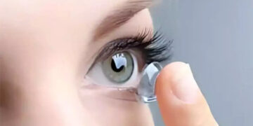The discovery of 5 contact lenses hidden behind the eye of a woman in Beijing, China has shocked doctors.