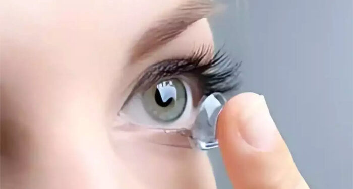 The discovery of 5 contact lenses hidden behind the eye of a woman in Beijing, China has shocked doctors.