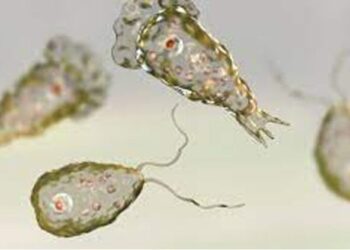 36-year-old woman dies from brain-eating amoeba in Karachi