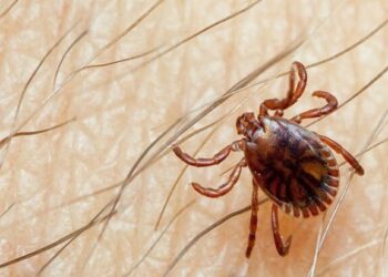 Karachi reports third Congo fever death this year