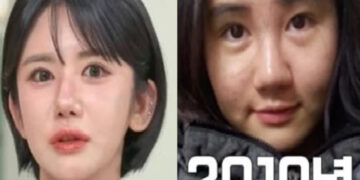 Woman who spent over 50 million rupees on 400 plastic surgeries