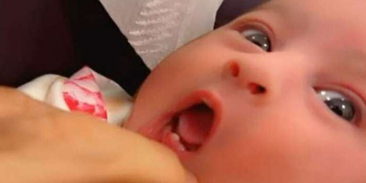 Baby Girl’s teeth came out 6 days after birth.