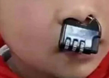 The child got a lock in the nose!.