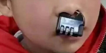 The child got a lock in the nose!.