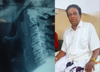 Teeth cleaning led to death.