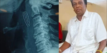 Teeth cleaning led to death.