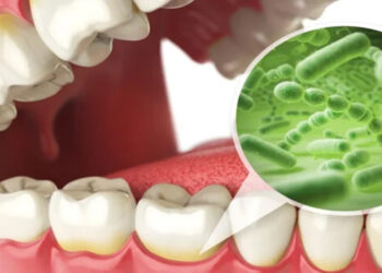 Don’t underestimate oral germs, research reveals serious findings.