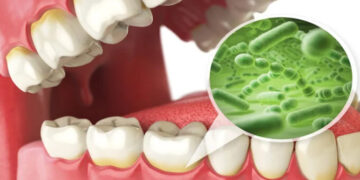 Don’t underestimate oral germs, research reveals serious findings.