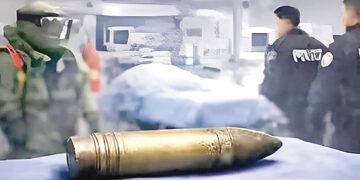 World War II bomb found in patient’s body in France.