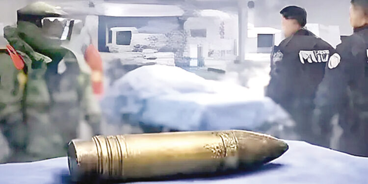 World War II bomb found in patient’s body in France.