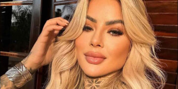 Brazilian influencer who underwent plastic surgery dies suddenly, cause revealed.