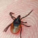 First Congo Virus Death of 2026 Reported in Karachi as 17-Year-Old Succumbs to CCHF Infection