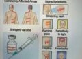 Pakistan Urges Citizens Aged 50+ to Get Shingles Vaccine as Experts Warn of Rising Risk and Complications