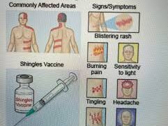Pakistan Urges Citizens Aged 50+ to Get Shingles Vaccine as Experts Warn of Rising Risk and Complications