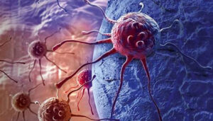 A healthcare professional reviewing cancer screening results as the WHO reports a projected increase in global cancer cases by 2050.