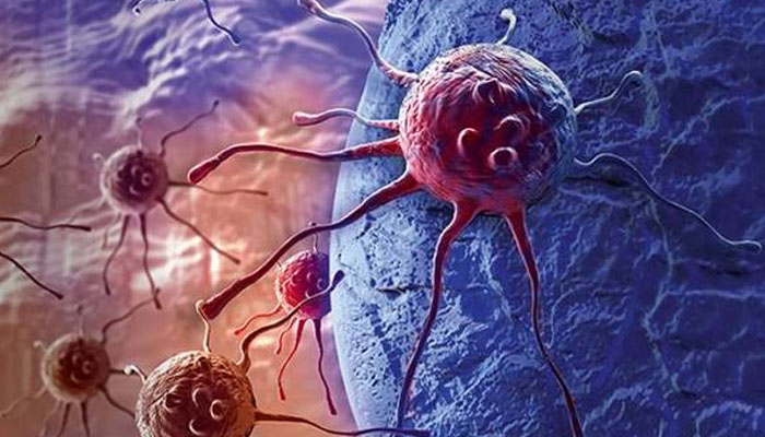 A healthcare professional reviewing cancer screening results as the WHO reports a projected increase in global cancer cases by 2050.