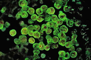 Brain-eating amoeba Naegleria fowleri linked to rare infections in warm freshwater